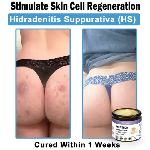 Turonu® Bee Venom Skin Treatment Cream