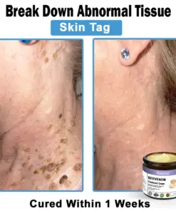 Turonu® Bee Venom Skin Treatment Cream