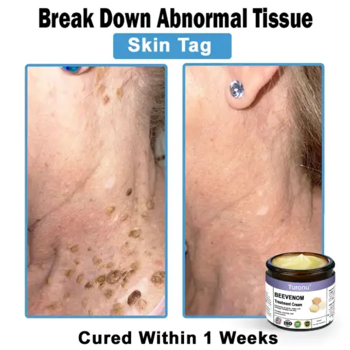 Turonu® Bee Venom Skin Treatment Cream