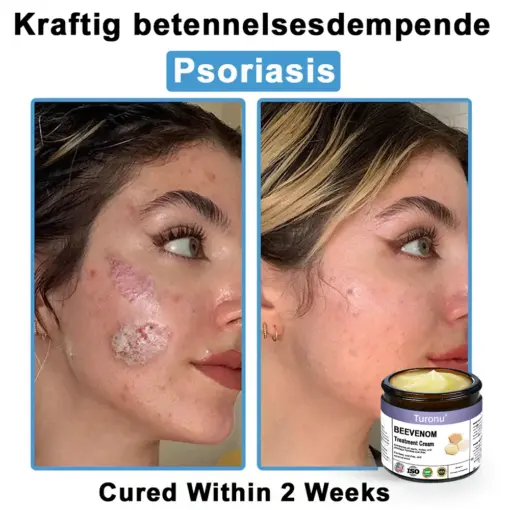 Turonu® Bee Venom Skin Treatment Cream