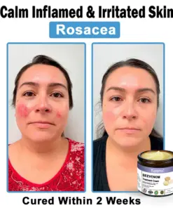 Turonu® Bee Venom Skin Treatment Cream