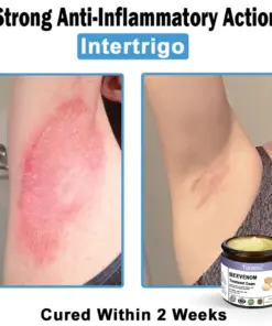 Turonu® Bee Venom Skin Treatment Cream