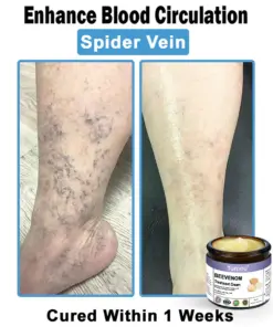 Turonu® Bee Venom Skin Treatment Cream