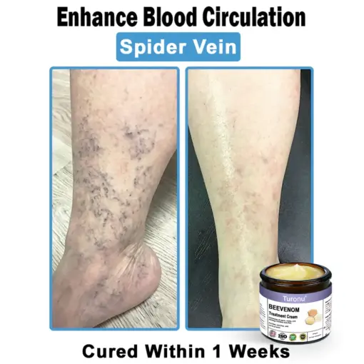 Turonu® Bee Venom Skin Treatment Cream