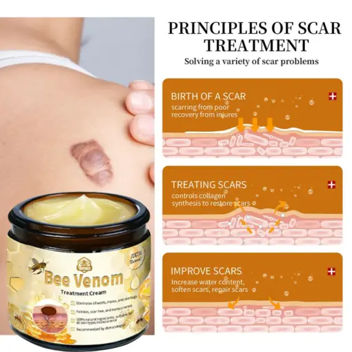Turonu® Bee Venom Treatment Cream