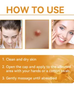 Turonu® Bee Venom Treatment Cream