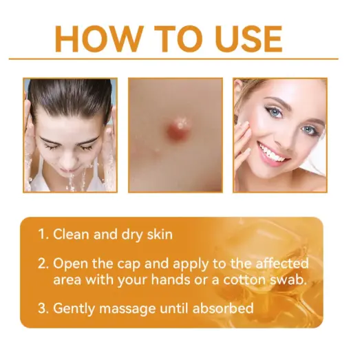 Turonu® Bee Venom Treatment Cream