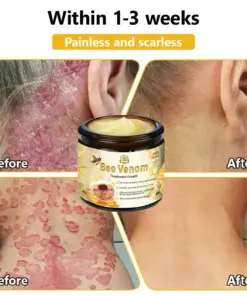 Turonu® Bee Venom Treatment Cream