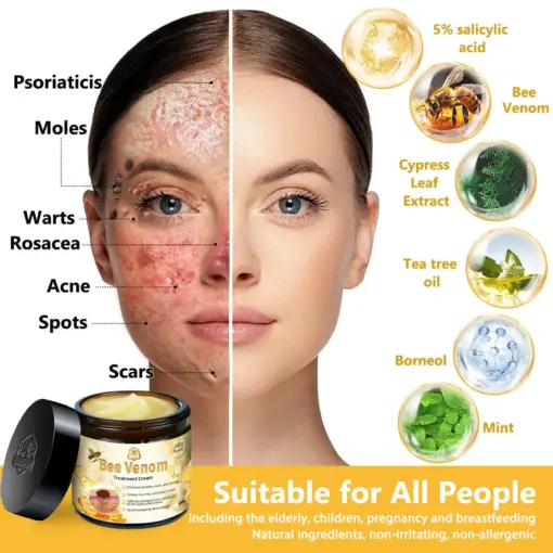 Turonu® Bee Venom Treatment Cream