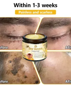 Turonu® Bee Venom Treatment Cream