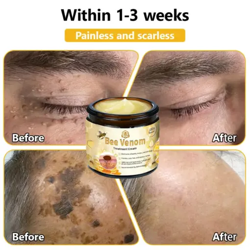 Turonu® Bee Venom Treatment Cream