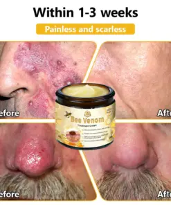 Turonu® Bee Venom Treatment Cream