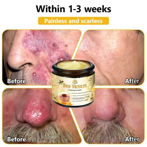 Turonu® Bee Venom Treatment Cream