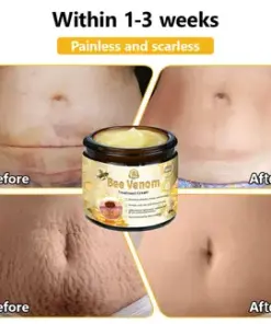 Turonu® Bee Venom Treatment Cream