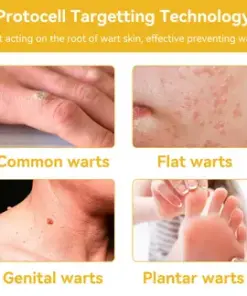 Turonu® Bee Venom Treatment Cream