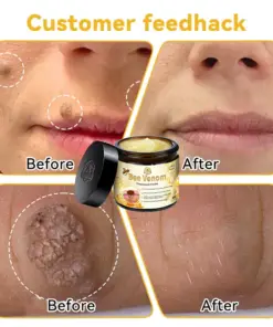 Turonu™ New Zealand Bee Venom Skin Treatment Cream
