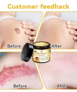 Turonu™ New Zealand Bee Venom Skin Treatment Cream