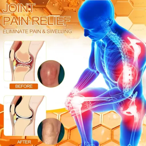 𝑇𝑢𝑟𝑜𝑛𝑢™ Bee Venom Joint & Bone Therapy Cream