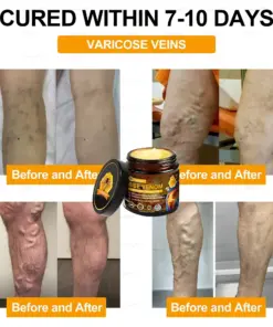 𝑇𝑢𝑟𝑜𝑛𝑢™ Bee Venom Joint & Bone Therapy Cream