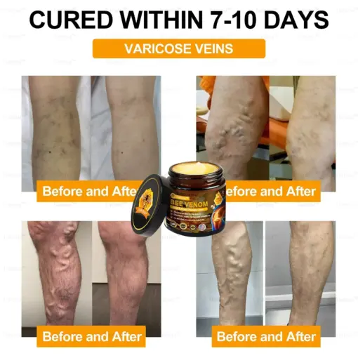 𝑇𝑢𝑟𝑜𝑛𝑢™ Bee Venom Joint & Bone Therapy Cream