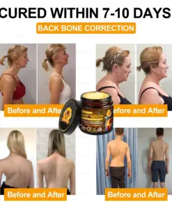 𝑇𝑢𝑟𝑜𝑛𝑢™ Bee Venom Joint & Bone Therapy Cream