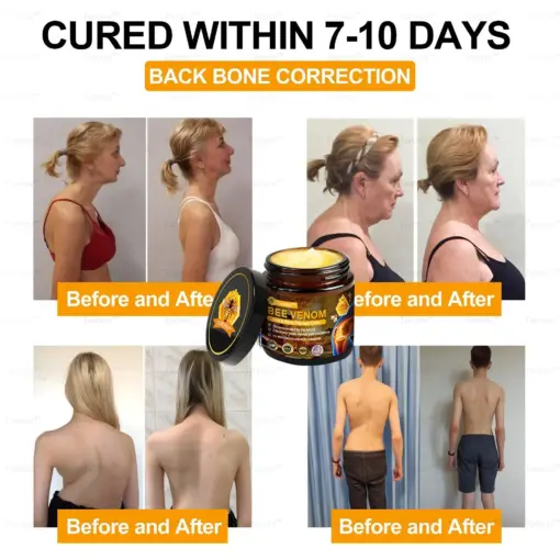𝑇𝑢𝑟𝑜𝑛𝑢™ Bee Venom Joint & Bone Therapy Cream