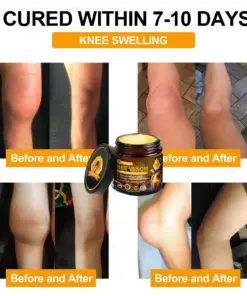 𝑇𝑢𝑟𝑜𝑛𝑢™ Bee Venom Joint & Bone Therapy Cream