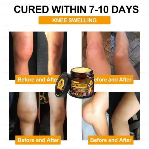 𝑇𝑢𝑟𝑜𝑛𝑢™ Bee Venom Joint & Bone Therapy Cream