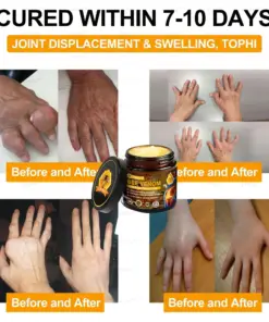 𝑇𝑢𝑟𝑜𝑛𝑢™ Bee Venom Joint & Bone Therapy Cream