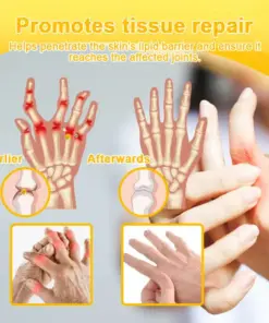Turonu® Botulinum Toxin & Bee Venom Pain-Relief Bone Healing Cream