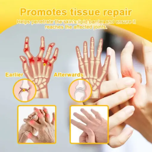Turonu® Botulinum Toxin & Bee Venom Pain-Relief Bone Healing Cream