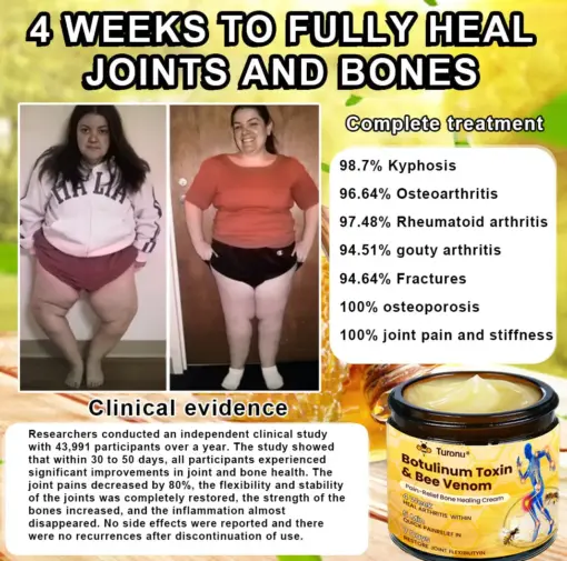 Turonu® Botulinum Toxin & Bee Venom Pain-Relief Bone Healing Cream