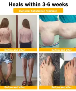 Turonu® Botulinum Toxin & Bee Venom Pain-Relief Bone Healing Cream