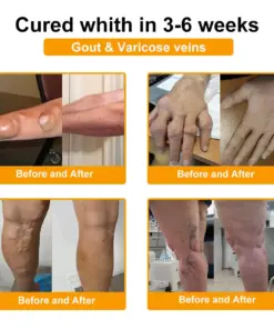 Turonu® Botulinum Toxin & Bee Venom Pain-Relief Bone Healing Cream