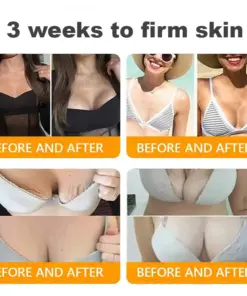 𝐓𝐮𝐫𝐨𝐧𝐮® 𝐁𝐞𝐞 𝐕𝐞𝐧𝐨𝐦 𝐌𝐮𝐥𝐭𝐢-𝐂𝐚𝐫𝐞 𝐒𝐤𝐢𝐧 𝐑𝐞𝐩𝐚𝐢𝐫 𝐂𝐫𝐞𝐚𝐦