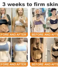 𝐓𝐮𝐫𝐨𝐧𝐮® 𝐁𝐞𝐞 𝐕𝐞𝐧𝐨𝐦 𝐌𝐮𝐥𝐭𝐢-𝐂𝐚𝐫𝐞 𝐒𝐤𝐢𝐧 𝐑𝐞𝐩𝐚𝐢𝐫 𝐂𝐫𝐞𝐚𝐦
