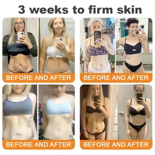 𝐓𝐮𝐫𝐨𝐧𝐮® 𝐁𝐞𝐞 𝐕𝐞𝐧𝐨𝐦 𝐌𝐮𝐥𝐭𝐢-𝐂𝐚𝐫𝐞 𝐒𝐤𝐢𝐧 𝐑𝐞𝐩𝐚𝐢𝐫 𝐂𝐫𝐞𝐚𝐦