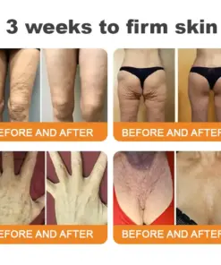𝐓𝐮𝐫𝐨𝐧𝐮® 𝐁𝐞𝐞 𝐕𝐞𝐧𝐨𝐦 𝐌𝐮𝐥𝐭𝐢-𝐂𝐚𝐫𝐞 𝐒𝐤𝐢𝐧 𝐑𝐞𝐩𝐚𝐢𝐫 𝐂𝐫𝐞𝐚𝐦