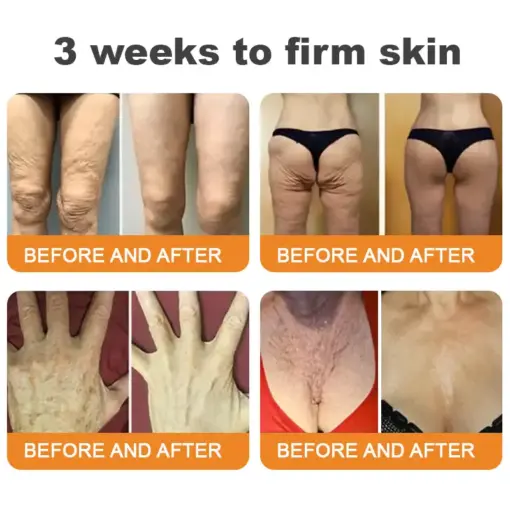 𝐓𝐮𝐫𝐨𝐧𝐮® 𝐁𝐞𝐞 𝐕𝐞𝐧𝐨𝐦 𝐌𝐮𝐥𝐭𝐢-𝐂𝐚𝐫𝐞 𝐒𝐤𝐢𝐧 𝐑𝐞𝐩𝐚𝐢𝐫 𝐂𝐫𝐞𝐚𝐦