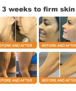 𝐓𝐮𝐫𝐨𝐧𝐮® 𝐁𝐞𝐞 𝐕𝐞𝐧𝐨𝐦 𝐌𝐮𝐥𝐭𝐢-𝐂𝐚𝐫𝐞 𝐒𝐤𝐢𝐧 𝐑𝐞𝐩𝐚𝐢𝐫 𝐂𝐫𝐞𝐚𝐦