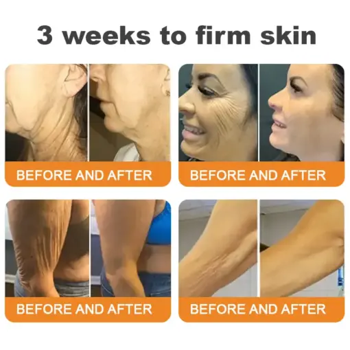 𝐓𝐮𝐫𝐨𝐧𝐮® 𝐁𝐞𝐞 𝐕𝐞𝐧𝐨𝐦 𝐌𝐮𝐥𝐭𝐢-𝐂𝐚𝐫𝐞 𝐒𝐤𝐢𝐧 𝐑𝐞𝐩𝐚𝐢𝐫 𝐂𝐫𝐞𝐚𝐦