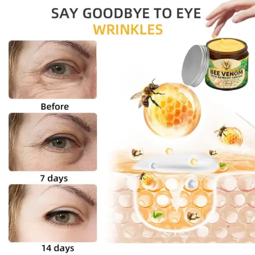 𝐓𝐮𝐫𝐨𝐧𝐮® 𝐁𝐞𝐞 𝐕𝐞𝐧𝐨𝐦 𝐒𝐤𝐢𝐧 𝐑𝐞𝐦𝐞𝐝𝐲 𝐂𝐫𝐞𝐚𝐦