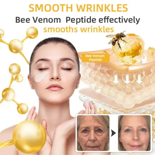 𝐓𝐮𝐫𝐨𝐧𝐮® 𝐁𝐞𝐞 𝐕𝐞𝐧𝐨𝐦 𝐒𝐤𝐢𝐧 𝐑𝐞𝐦𝐞𝐝𝐲 𝐂𝐫𝐞𝐚𝐦