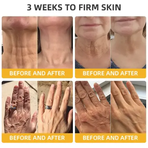 𝐓𝐮𝐫𝐨𝐧𝐮® 𝐁𝐞𝐞 𝐕𝐞𝐧𝐨𝐦 𝐒𝐤𝐢𝐧 𝐑𝐞𝐦𝐞𝐝𝐲 𝐂𝐫𝐞𝐚𝐦