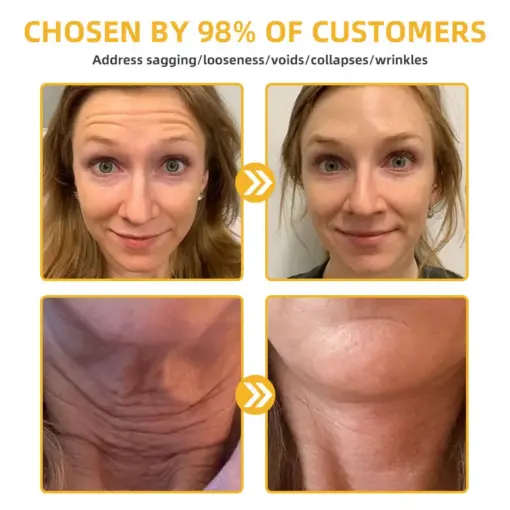 𝐓𝐮𝐫𝐨𝐧𝐮® 𝐁𝐞𝐞 𝐕𝐞𝐧𝐨𝐦 𝐒𝐤𝐢𝐧 𝐑𝐞𝐦𝐞𝐝𝐲 𝐂𝐫𝐞𝐚𝐦