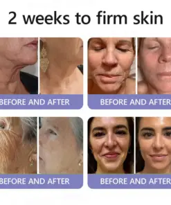 Turonu® Wrinkle-Reducing & Lifting Roller Cream