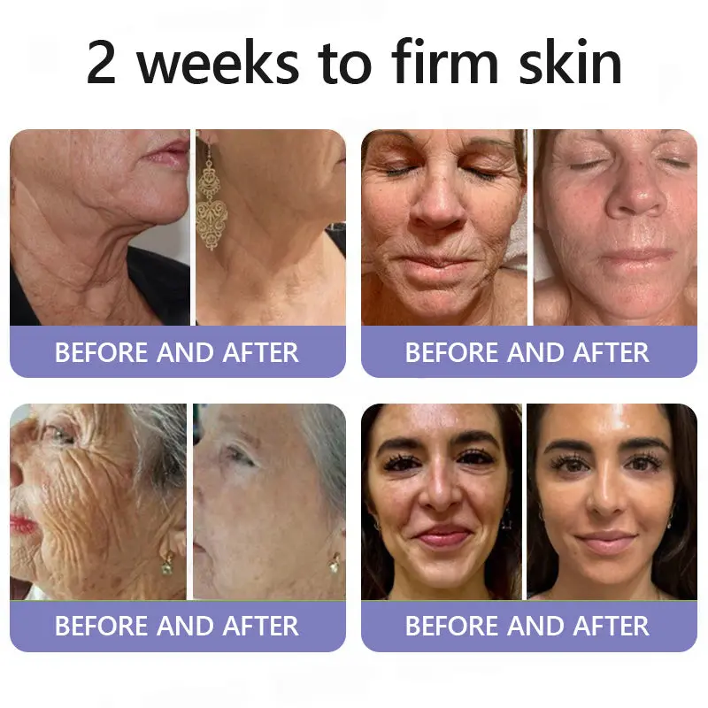 Turonu® Wrinkle-Reducing & Lifting Roller Cream