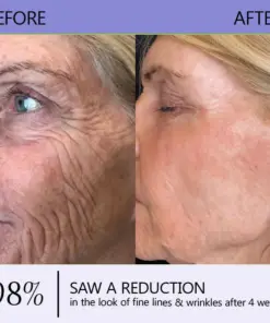Turonu® Wrinkle-Reducing & Lifting Roller Cream