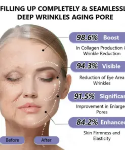 Turonu® Wrinkle-Reducing & Lifting Roller Cream
