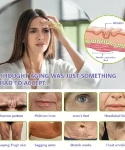 Turonu® Wrinkle-Reducing & Lifting Roller Cream